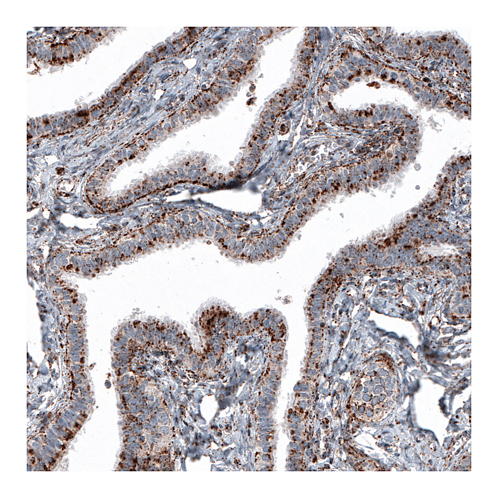 Atlas Antibodies Anti-LAMP1 Antibody