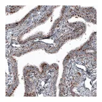 Atlas Antibodies Anti-LAMP1 Antibody