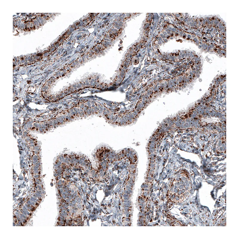 Atlas Antibodies Anti-LAMP1 Antibody