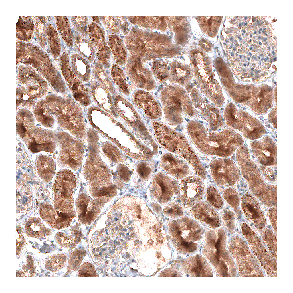 Atlas Antibodies Anti-LAPTM4B Antibody