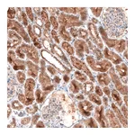 Atlas Antibodies Anti-LAPTM4B Antibody