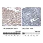 Atlas Antibodies Anti-LAPTM4B Antibody