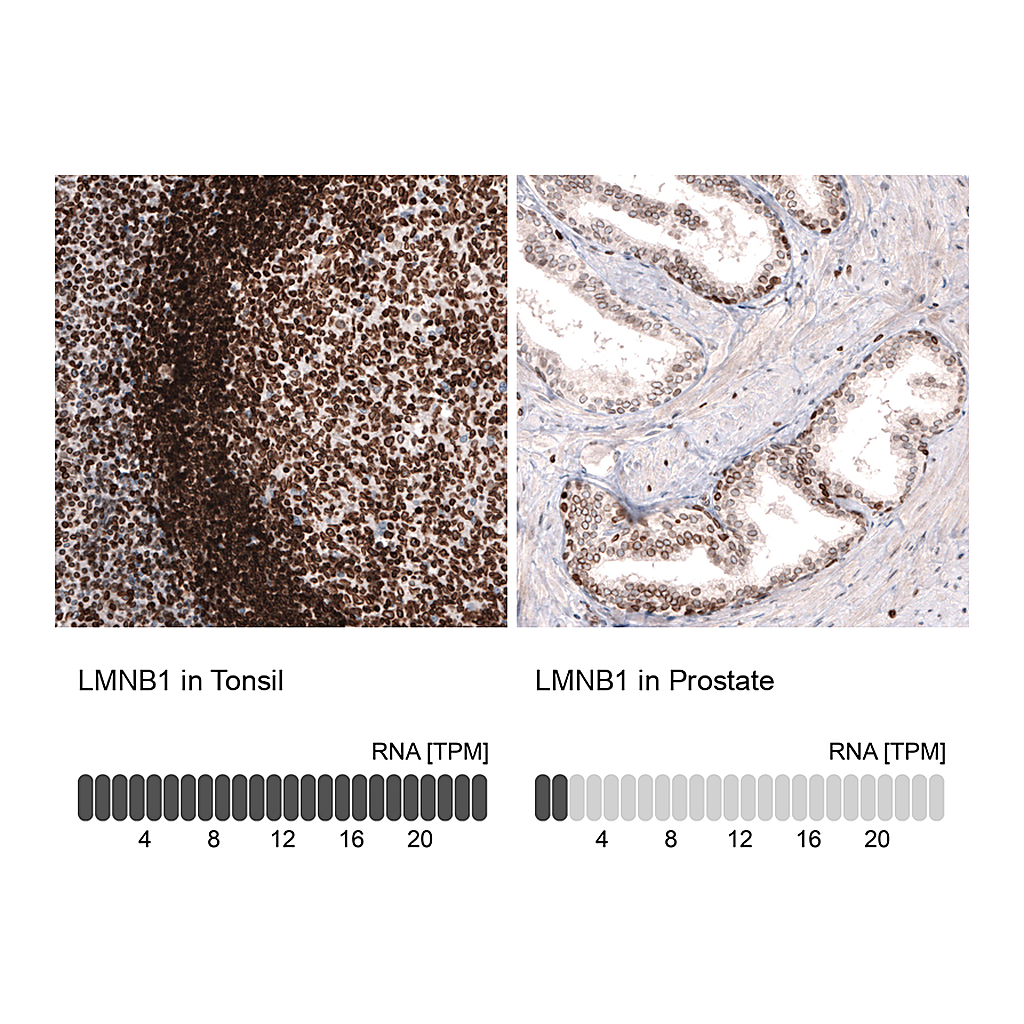 Atlas Antibodies Anti-LMNB1 Antibody