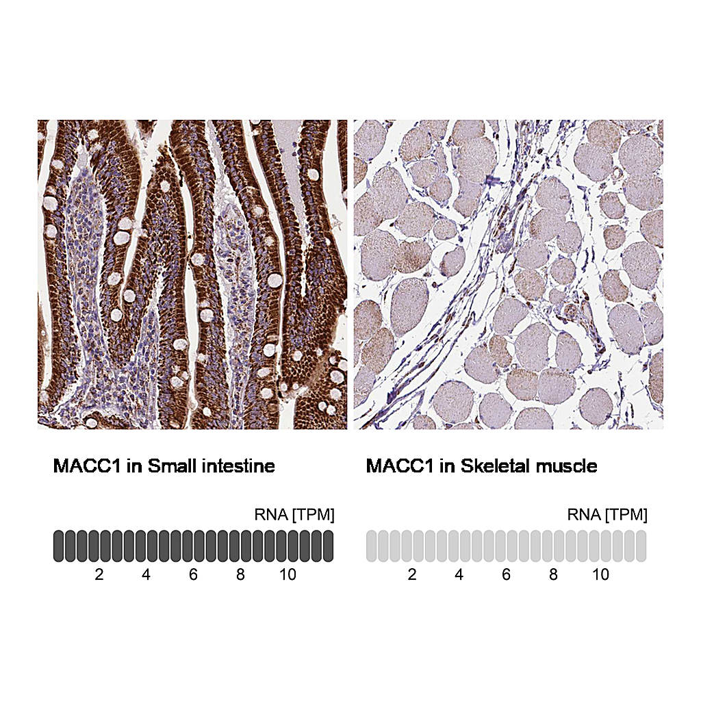 Atlas Antibodies Anti-MACC1 Antibody