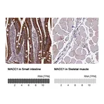 Atlas Antibodies Anti-MACC1 Antibody