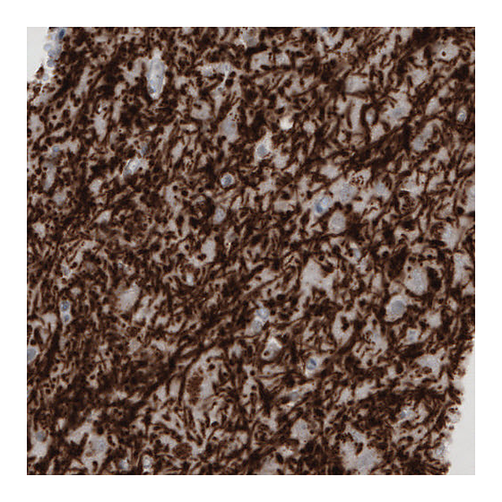 Atlas Antibodies Anti-MBP Antibody