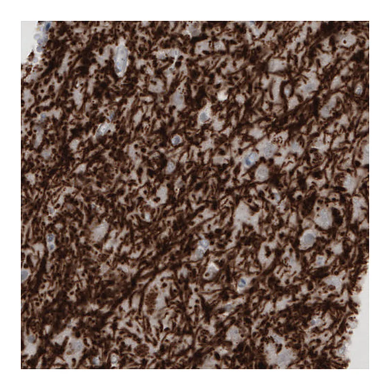 Atlas Antibodies Anti-MBP Antibody
