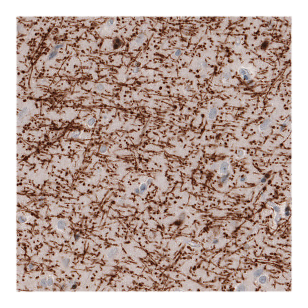 Atlas Antibodies Anti-MBP Antibody