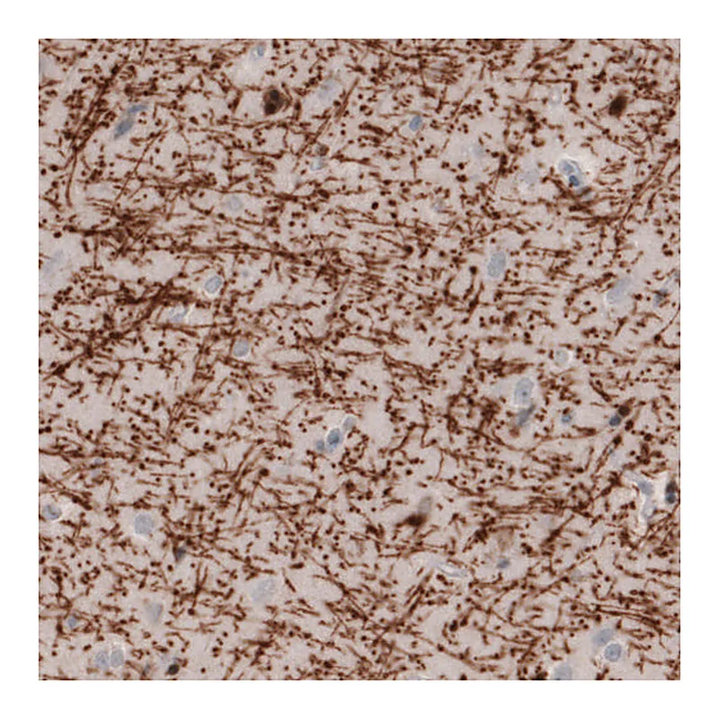 Atlas Antibodies Anti-MBP Antibody