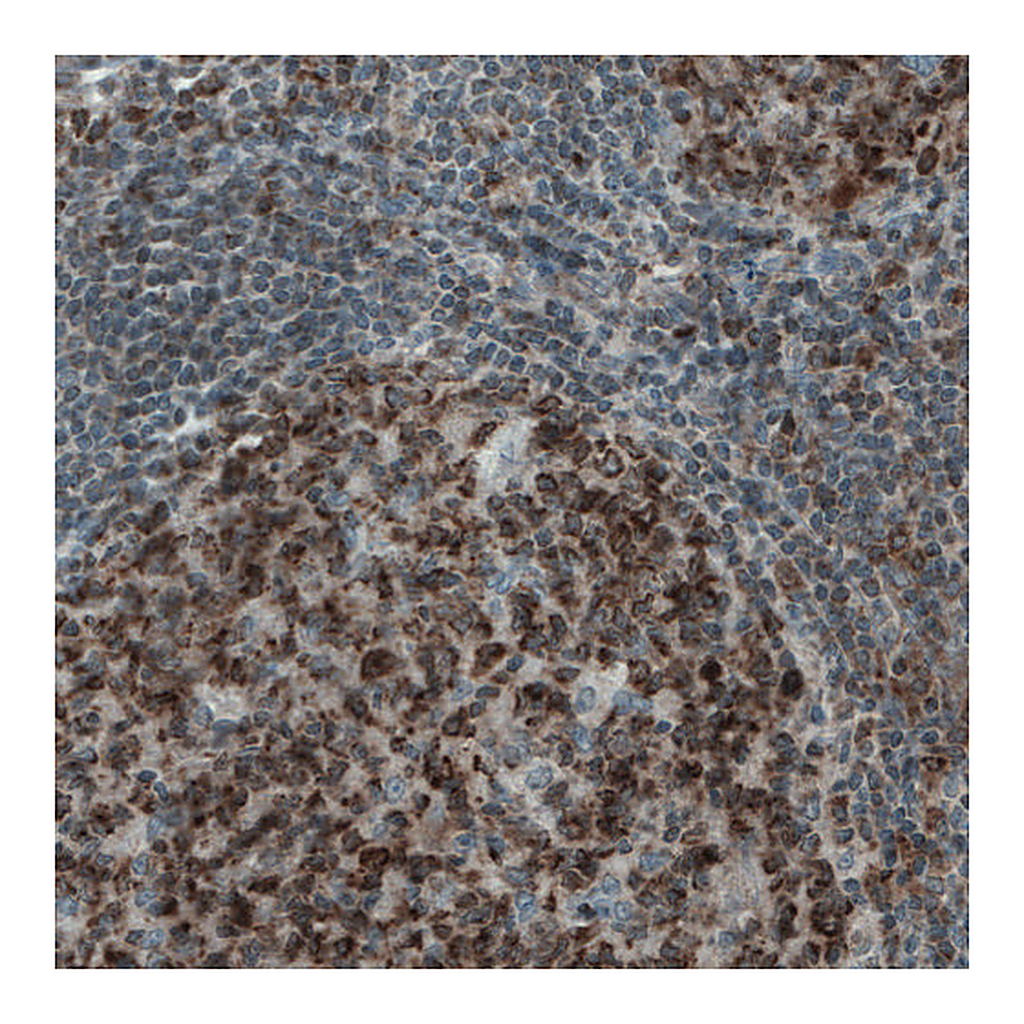 Atlas Antibodies Anti-MCL1 Antibody
