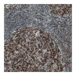 Atlas Antibodies Anti-MCL1 Antibody