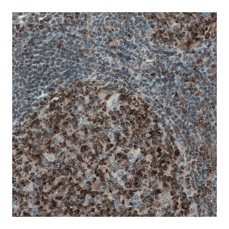 Atlas Antibodies Anti-MCL1 Antibody