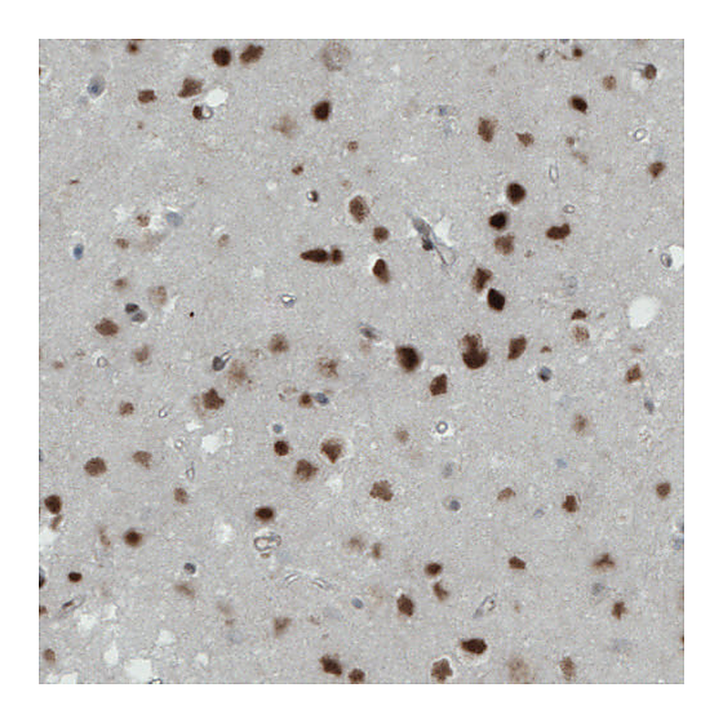 Atlas Antibodies Anti-MEF2C Antibody