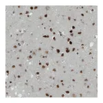 Atlas Antibodies Anti-MEF2C Antibody
