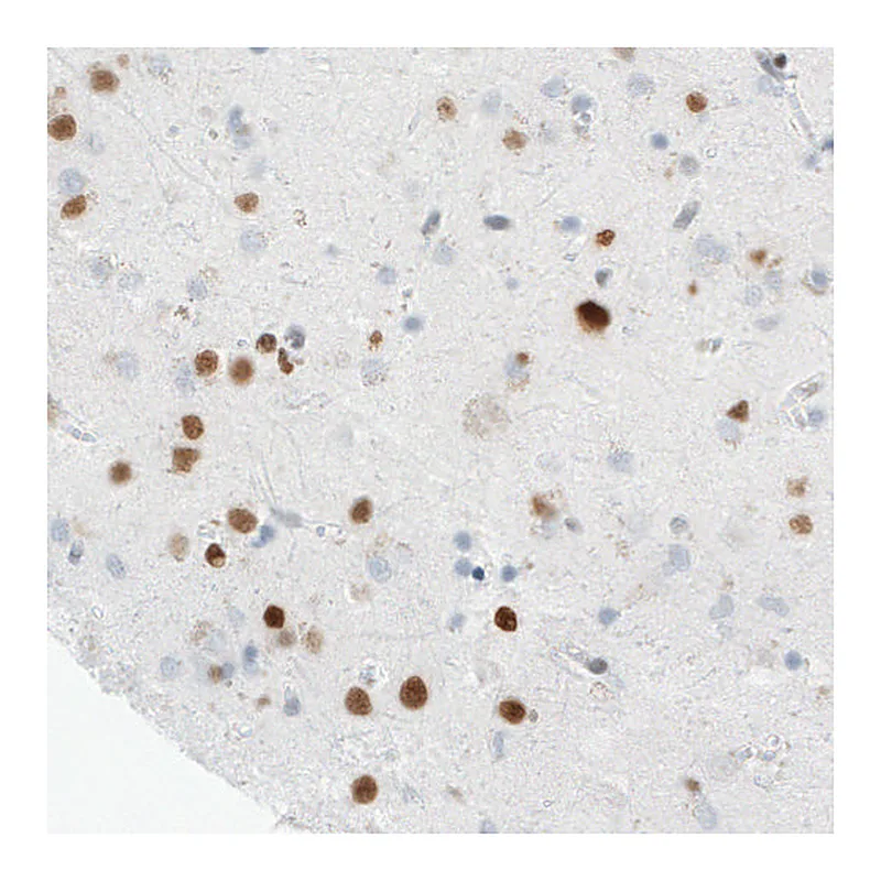 Atlas Antibodies Anti-MEF2C Antibody