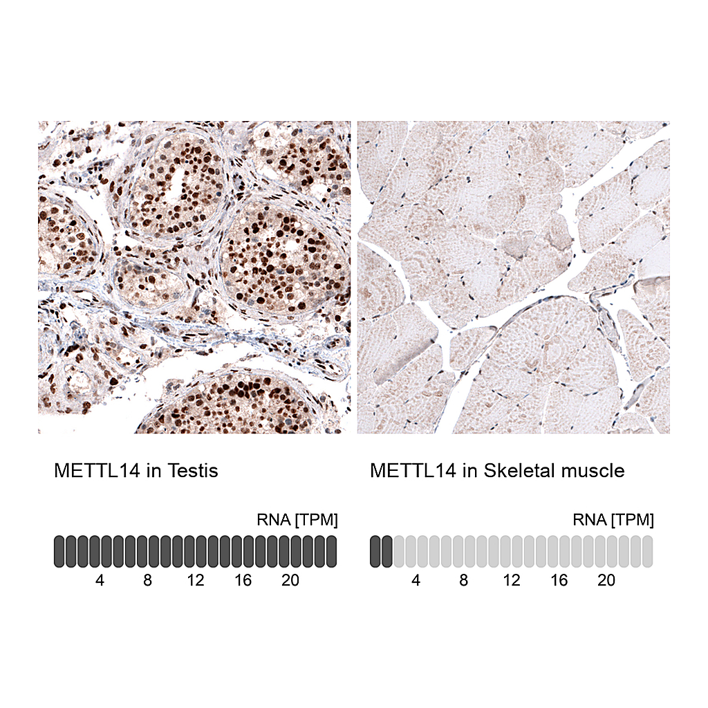 Atlas Antibodies Anti-METTL14 Antibody