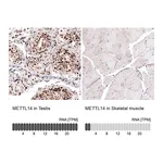 Atlas Antibodies Anti-METTL14 Antibody