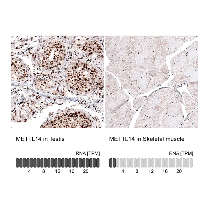 Atlas Antibodies Anti-METTL14 Antibody