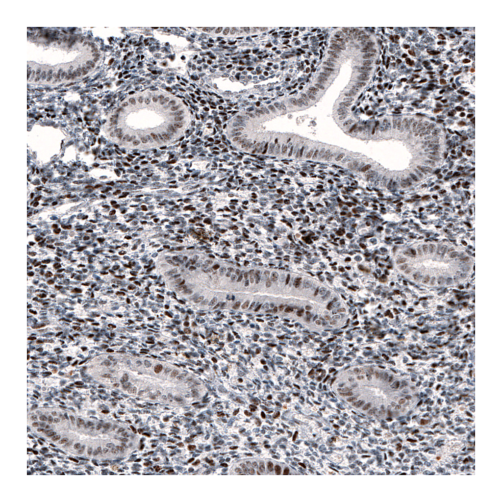 Atlas Antibodies Anti-METTL14 Antibody