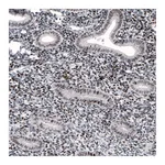 Atlas Antibodies Anti-METTL14 Antibody