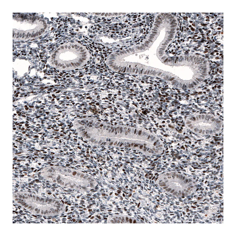Atlas Antibodies Anti-METTL14 Antibody