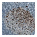 Atlas Antibodies Anti-MKI67 Antibody