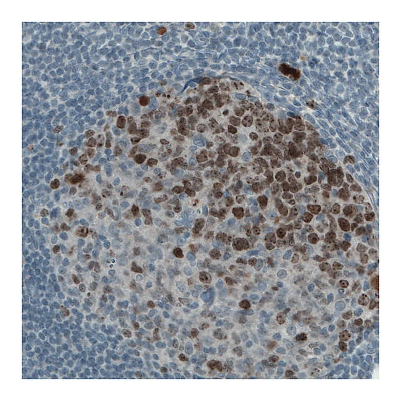 Atlas Antibodies Anti-MKI67 Antibody