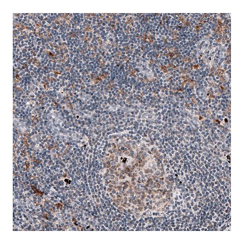 Atlas Antibodies Anti-MKL1 Antibody