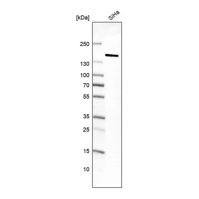 Atlas Antibodies Anti-MKL2 Antibody