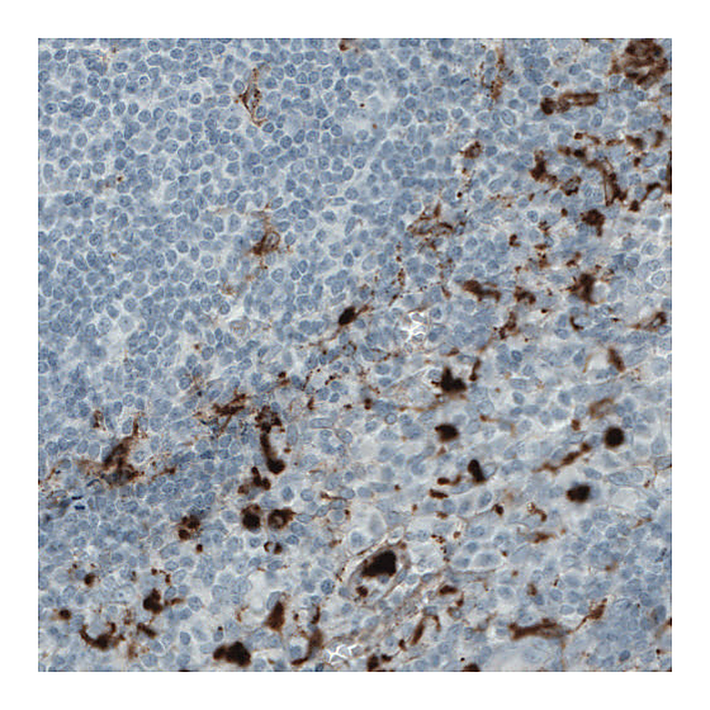 Atlas Antibodies Anti-MMP9 Antibody