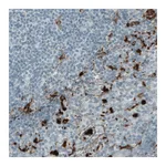 Atlas Antibodies Anti-MMP9 Antibody