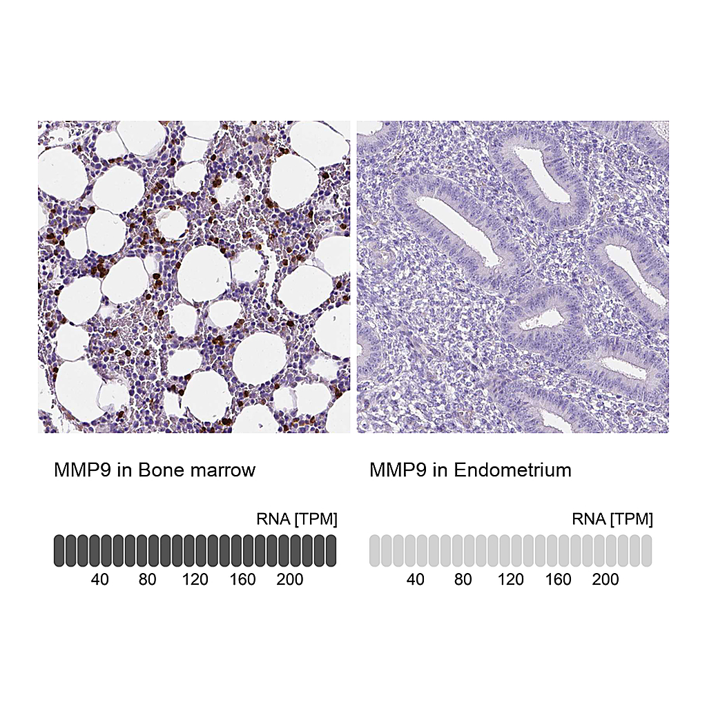 Atlas Antibodies Anti-MMP9 Antibody
