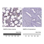 Atlas Antibodies Anti-MMP9 Antibody