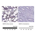 Atlas Antibodies Anti-MMP9 Antibody