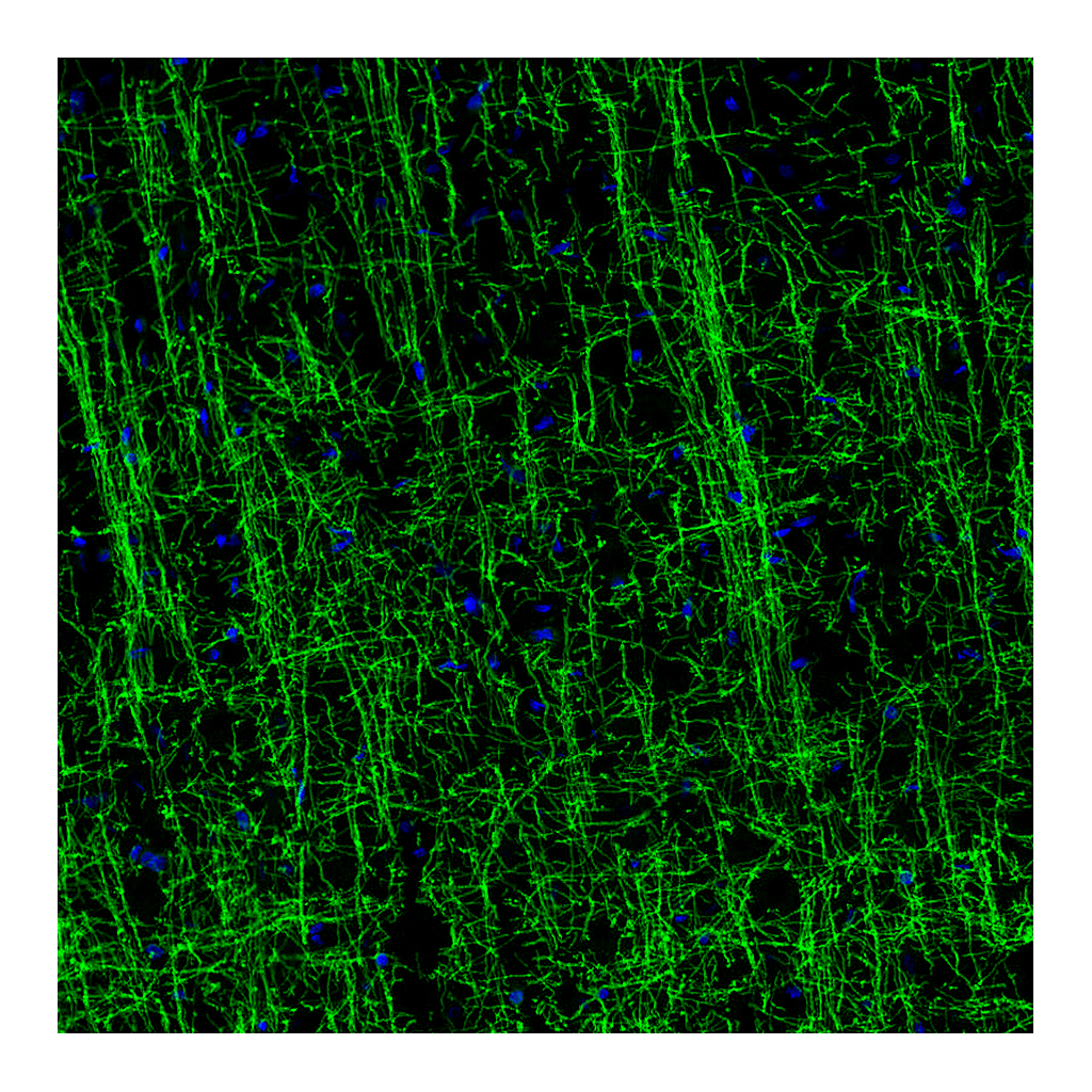 Atlas Antibodies Anti-MOG Antibody