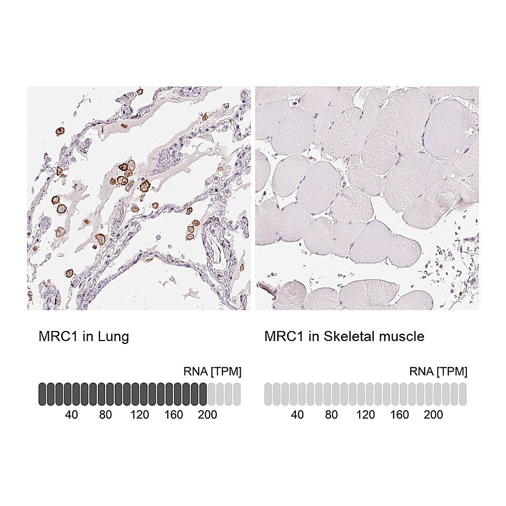 Atlas Antibodies Anti-MRC1 Antibody