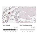 Atlas Antibodies Anti-MRC1 Antibody