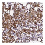 Atlas Antibodies Anti-MTDH Antibody