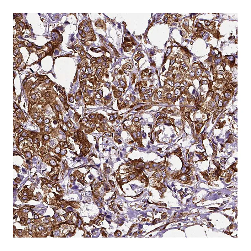 Atlas Antibodies Anti-MTDH Antibody