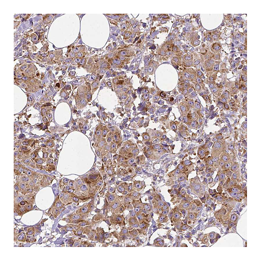 Atlas Antibodies Anti-MTDH Antibody