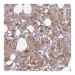 Atlas Antibodies Anti-MTDH Antibody