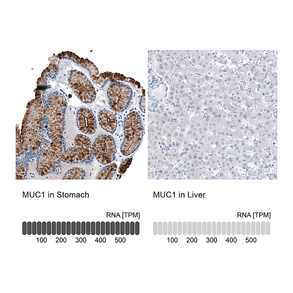 Atlas Antibodies Anti-MUC1 Antibody