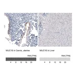 Atlas Antibodies Anti-MUC16 Antibody