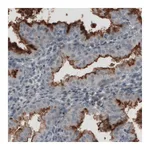 Atlas Antibodies Anti-MUC16 Antibody