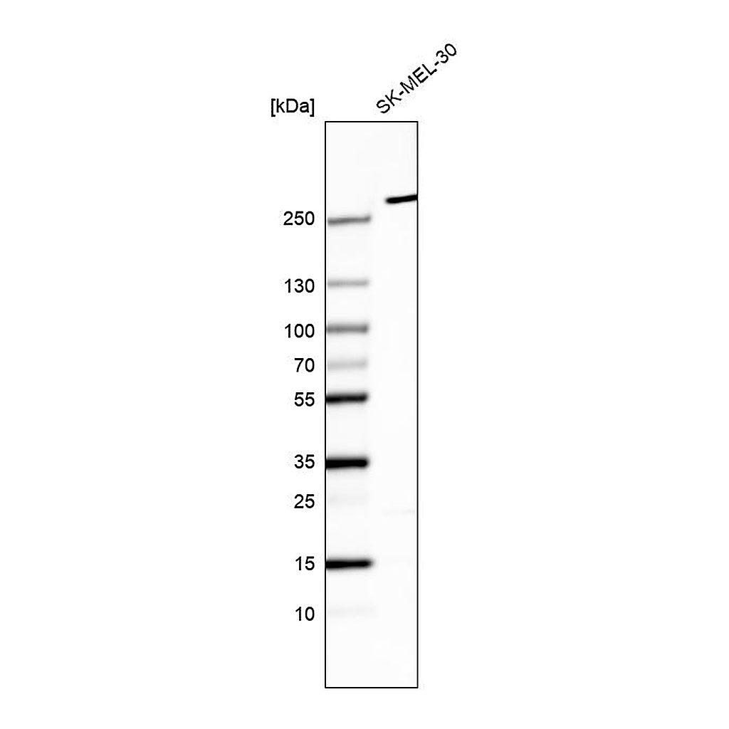 Atlas Antibodies Anti-MYO10 Antibody