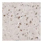 Atlas Antibodies Anti-MYO10 Antibody