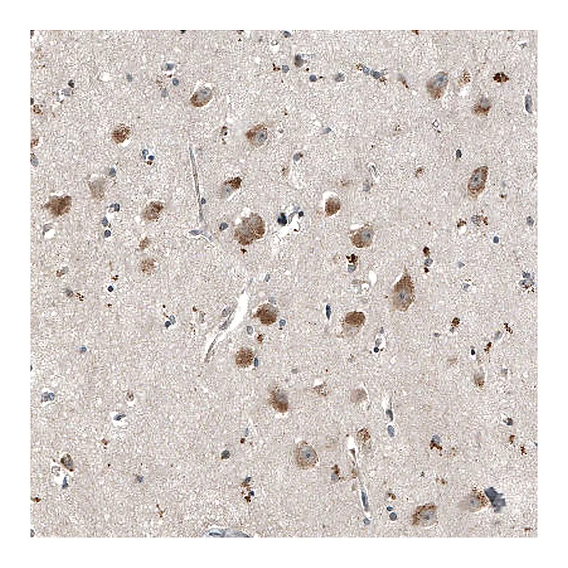 Atlas Antibodies Anti-MYO10 Antibody