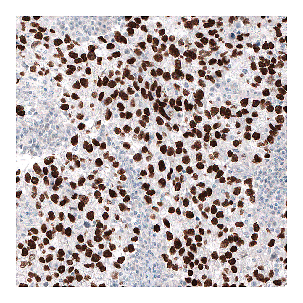 Atlas Antibodies Anti-NANOG Antibody