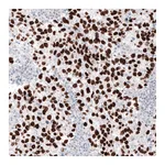 Atlas Antibodies Anti-NANOG Antibody