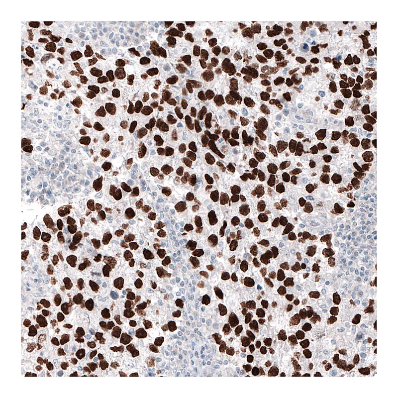 Atlas Antibodies Anti-NANOG Antibody